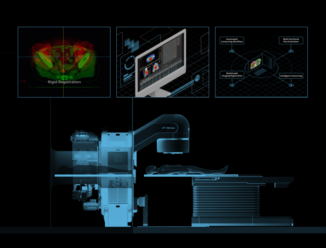 Intelligent Radiotherapy Platform workflow