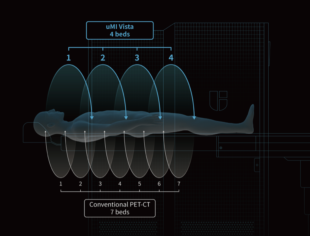 a scan of the whole body with only 4-beds-positions